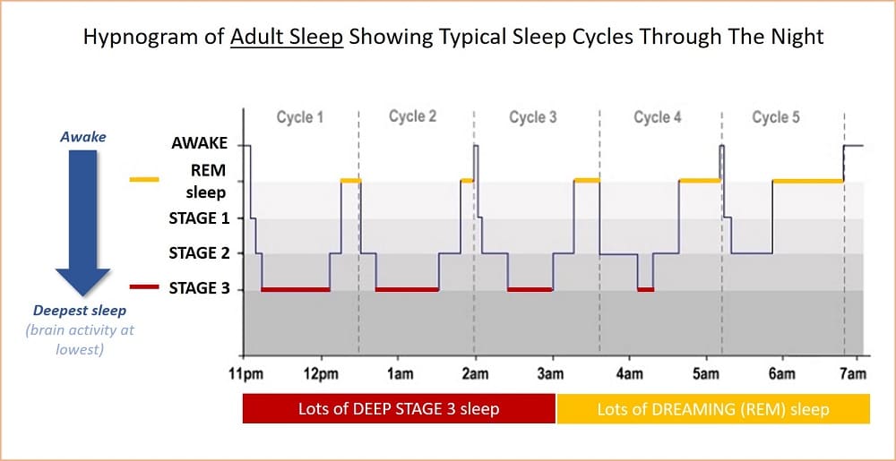 خواب طبیعی و مراحل و چرخه آن - بی خوابی, اختلالات خواب, Sleep - %d8%a8%d8%b1%d8%a7%db%8c-%d8%a8%db%8c%d9%85%d8%a7%d8%b1%d8%a7%d9%86